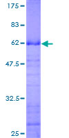 ING2 Protein - 12.5% SDS-PAGE of human ING2 stained with Coomassie Blue
