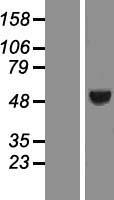 ING3 Protein - Western validation with an anti-DDK antibody * L: Control HEK293 lysate R: Over-expression lysate