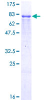 ING3 Protein - 12.5% SDS-PAGE of human ING3 stained with Coomassie Blue