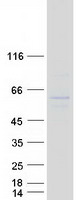 ING3 Protein - Purified recombinant protein ING3 was analyzed by SDS-PAGE gel and Coomassie Blue Staining