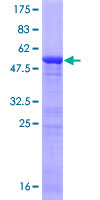 ING5 Protein - 12.5% SDS-PAGE of human ING5 stained with Coomassie Blue