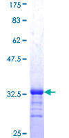 ING5 Protein - 12.5% SDS-PAGE Stained with Coomassie Blue.