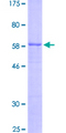 INHA / Inhibin Alpha Protein - 12.5% SDS-PAGE of human INHA stained with Coomassie Blue