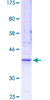 INHA / Inhibin Alpha Protein - 12.5% SDS-PAGE Stained with Coomassie Blue.