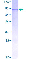 INHBA / Inhibin Beta A Protein - 12.5% SDS-PAGE of human INHBA stained with Coomassie Blue