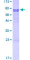 INHBB / Inhibin Beta B Protein - 12.5% SDS-PAGE of human INHBB stained with Coomassie Blue