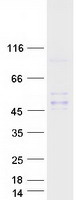 INHBC Protein - Purified recombinant protein INHBC was analyzed by SDS-PAGE gel and Coomassie Blue Staining