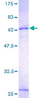 INHBE / Activin Protein - 12.5% SDS-PAGE of human INHBE stained with Coomassie Blue