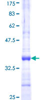INMT Protein - 12.5% SDS-PAGE Stained with Coomassie Blue.