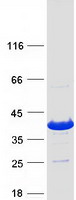 INO80E Protein - Purified recombinant protein INO80E was analyzed by SDS-PAGE gel and Coomassie Blue Staining