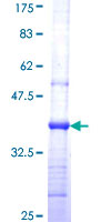 INPP1 Protein - 12.5% SDS-PAGE Stained with Coomassie Blue.