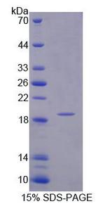 INPP4A Protein - Recombinant Inositol Polyphosphate-4-Phosphatase Type I 107kDa By SDS-PAGE
