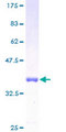 INPP4B Protein - 12.5% SDS-PAGE of human INPP4B stained with Coomassie Blue