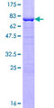 INPP5A Protein - 12.5% SDS-PAGE of human INPP5A stained with Coomassie Blue