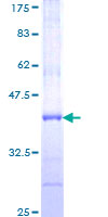 INPP5A Protein - 12.5% SDS-PAGE Stained with Coomassie Blue.