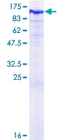 INPP5B Protein - 12.5% SDS-PAGE of human INPP5B stained with Coomassie Blue