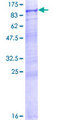 INPP5E Protein - 12.5% SDS-PAGE of human INPP5E stained with Coomassie Blue