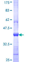 INPP5J / PIB5PA Protein - 12.5% SDS-PAGE Stained with Coomassie Blue.