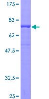 INPP5K / SKIP Protein - 12.5% SDS-PAGE of human INPP5K stained with Coomassie Blue