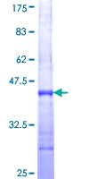 INPP5K / SKIP Protein - 12.5% SDS-PAGE Stained with Coomassie Blue.