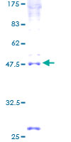 INSIG2 Protein - 12.5% SDS-PAGE of human INSIG2 stained with Coomassie Blue