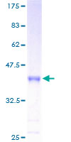 INSL4 Protein - 12.5% SDS-PAGE of human INSL4 stained with Coomassie Blue