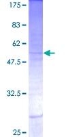 INSL5 Protein - 12.5% SDS-PAGE of human INSL5 stained with Coomassie Blue