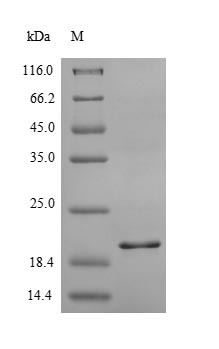 INSR / Insulin Receptor Protein - (Tris-Glycine gel) Discontinuous SDS-PAGE (reduced) with 5% enrichment gel and 15% separation gel.