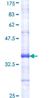 INSR / Insulin Receptor Protein - 12.5% SDS-PAGE Stained with Coomassie Blue.