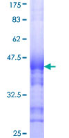 INSRR Protein - 12.5% SDS-PAGE Stained with Coomassie Blue.