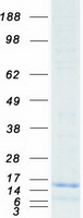 Insulin Protein - Purified recombinant protein INS was analyzed by SDS-PAGE gel and Coomassie Blue Staining