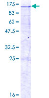 INT7 / INTS7 Protein - 12.5% SDS-PAGE of human INTS7 stained with Coomassie Blue
