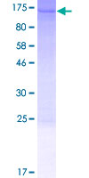 INTS3 Protein - 12.5% SDS-PAGE of human INTS3 stained with Coomassie Blue