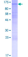 INTS5 Protein - 12.5% SDS-PAGE of human INTS5 stained with Coomassie Blue