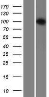 INTS6 Protein - Western validation with an anti-DDK antibody * L: Control HEK293 lysate R: Over-expression lysate