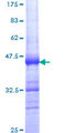 INTS6 Protein - 12.5% SDS-PAGE Stained with Coomassie Blue.