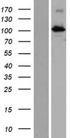 INTU Protein - Western validation with an anti-DDK antibody * L: Control HEK293 lysate R: Over-expression lysate