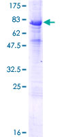 INTU Protein - 12.5% SDS-PAGE of human INTU stained with Coomassie Blue