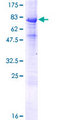 INTU Protein - 12.5% SDS-PAGE of human INTU stained with Coomassie Blue