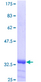 INVS / Inversin Protein - 12.5% SDS-PAGE of human INVS stained with Coomassie Blue