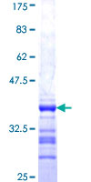 INVS / Inversin Protein - 12.5% SDS-PAGE Stained with Coomassie Blue.