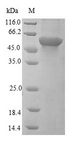 IP6K1 Protein - (Tris-Glycine gel) Discontinuous SDS-PAGE (reduced) with 5% enrichment gel and 15% separation gel.