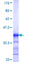 IP6K1 Protein - 12.5% SDS-PAGE Stained with Coomassie Blue.