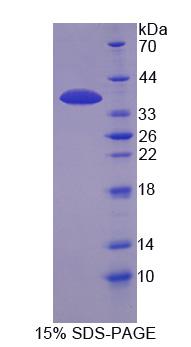 IP6K1 Protein - Recombinant  InositolHexaphosphateKinase1(IHPK1) By SDS-PAGE