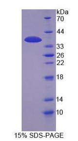IP6K1 Protein - Recombinant  InositolHexaphosphateKinase1(IHPK1) By SDS-PAGE