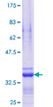 IP6K2 Protein - 12.5% SDS-PAGE Stained with Coomassie Blue.