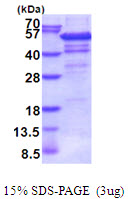 IP6K2 Protein