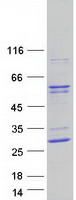 IP6K2 Protein - Purified recombinant protein IP6K2 was analyzed by SDS-PAGE gel and Coomassie Blue Staining