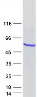 IP6K3 Protein - Purified recombinant protein IP6K3 was analyzed by SDS-PAGE gel and Coomassie Blue Staining