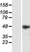 IPMK Protein - Western validation with an anti-DDK antibody * L: Control HEK293 lysate R: Over-expression lysate
